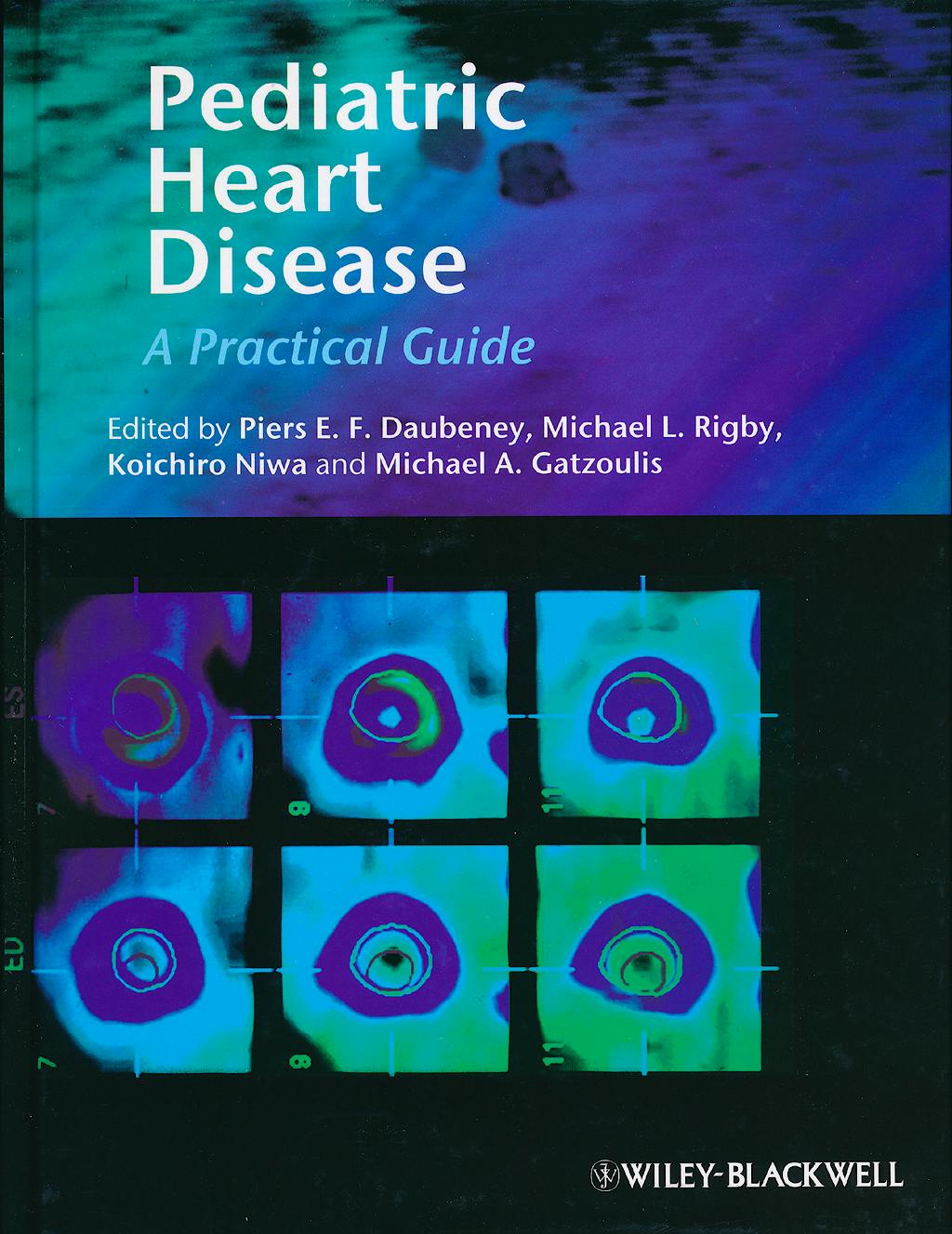 Portada del libro 9780727918611 Pediatric Heart Disease. a Clinical Guide