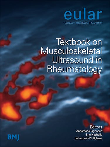 Portada del libro 9780727918666 EULAR Textbook on Musculoskeletal Ultrasound in Rheumatology