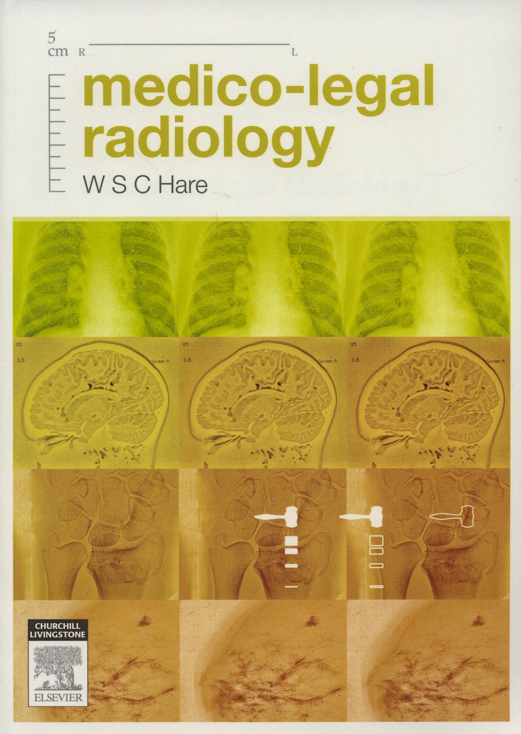 Portada del libro 9780729538312 Medico-Legal Radiology