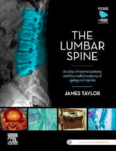 Portada del libro 9780729543132 The Lumbar Spine. An Atlas of Normal Anatomy and the Morbid Anatomy of Ageing and Injuries