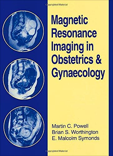 Portada del libro 9780750613217 Magnetic Resonance Imaging in Obstetrics and Gynaecology