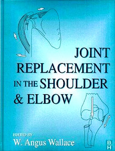 Portada del libro 9780750613675 Joint Replacement in the Shoulder and Elbow