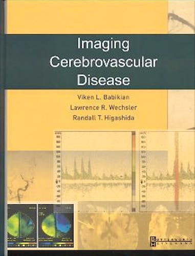 Portada del libro 9780750673020 Imaging Cerebrovascular Disease