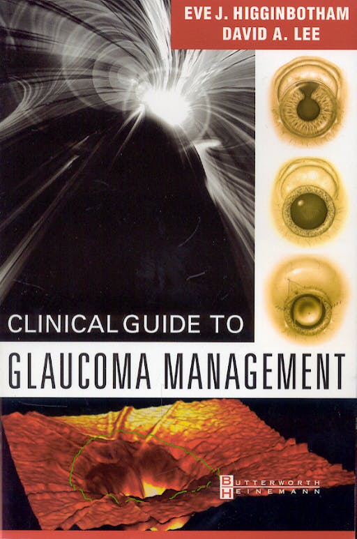 Portada del libro 9780750673105 Clinical Guide to Glaucoma Management