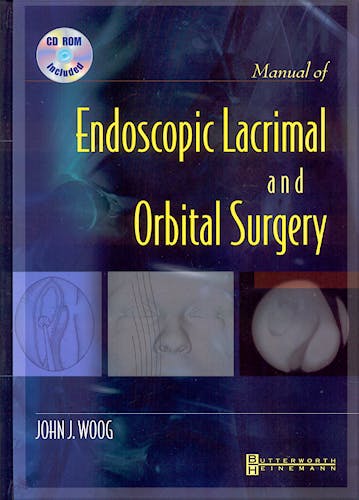 Portada del libro 9780750673266 Manual of Endoscopic Lacrimal and Orbital Surgery