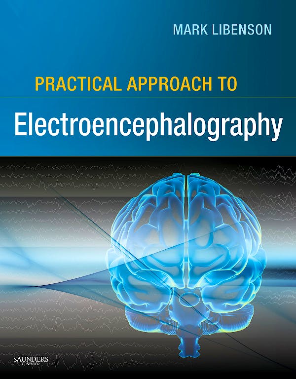 Portada del libro 9780750674782 Practical Approach to Electroencephalography