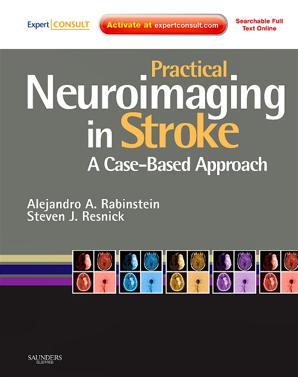Portada del libro 9780750675376 Practical Neuroimaging in Stroke. a Case-Based Approach (Online and Print)