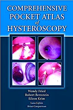 Portada del libro 9780763764371 Comprehensive Pocket Atlas of Hysteroscopy