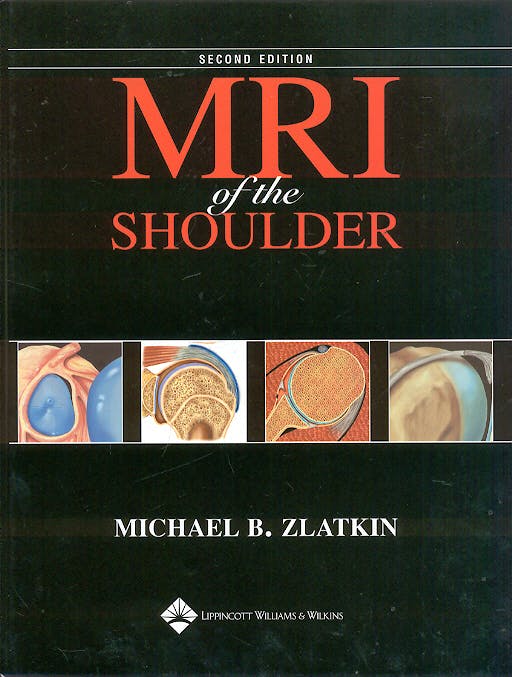Portada del libro 9780781715904 Mri of the Shoulder