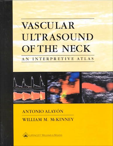 Portada del libro 9780781725347 Vascular Ultrasound of the Neck. An Interpretive Atlas