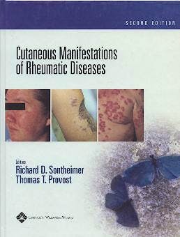 Portada del libro 9780781734783 Cutaneous Manifestations of Rheumatic Diseases