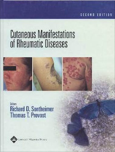 Portada del libro 9780781734783 Cutaneous Manifestations of Rheumatic Diseases