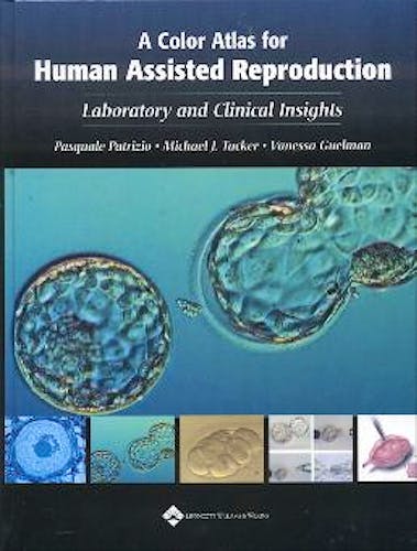 Portada del libro 9780781737692 A Colour Atlas of for Human Assisted Reproduction: Laboratory & Clinic