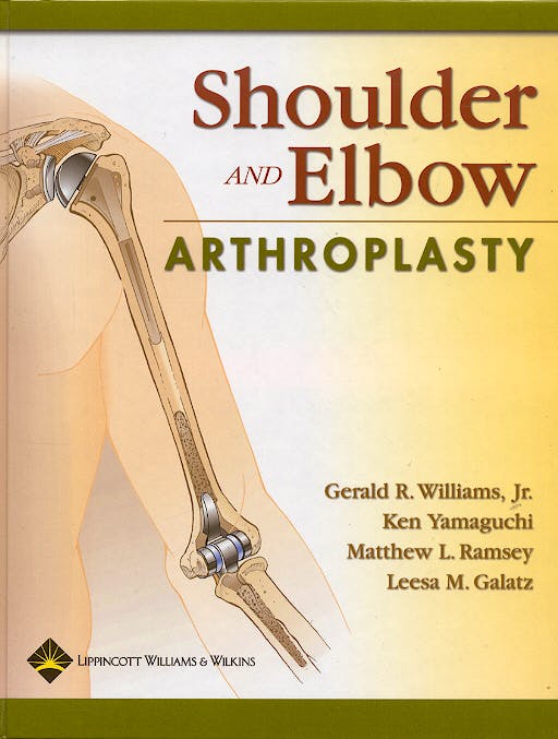 Portada del libro 9780781738538 Shoulder and Elbow Arthroplasty