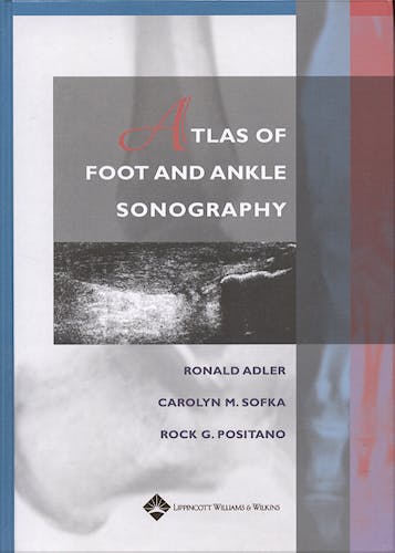 Portada del libro 9780781747691 Atlas of Foot and Ankle Sonography