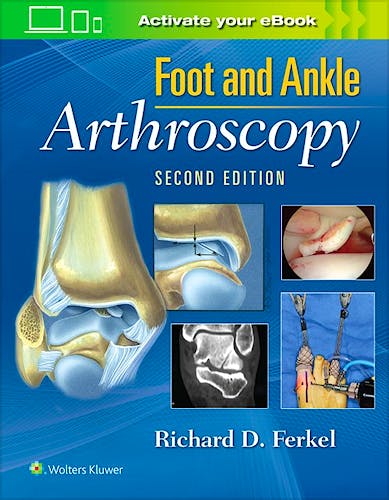 Portada del libro 9780781783415 Foot and Ankle Arthroscopy