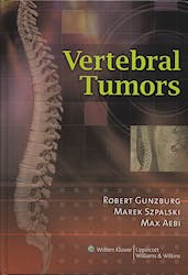 Vertebral Tumors