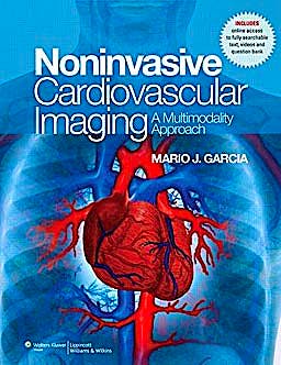 Portada del libro 9780781795357 Noninvasive Cardiovascular Imaging. a Multimodality Approach