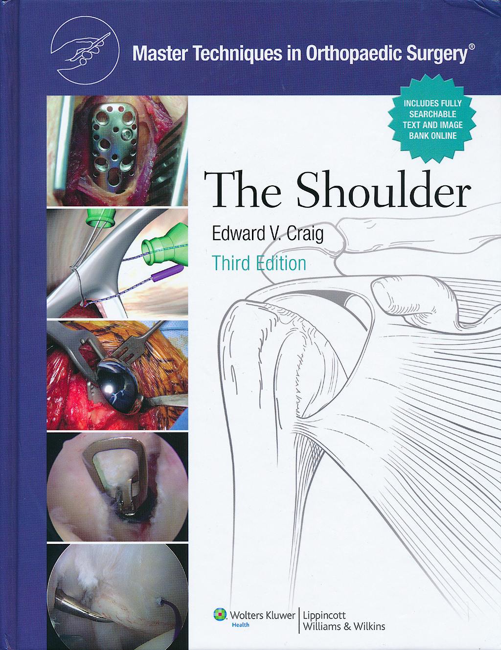 Portada del libro 9780781797481 Master Techniques in Orthopaedic Surgery. The Shoulder (Print and Online)