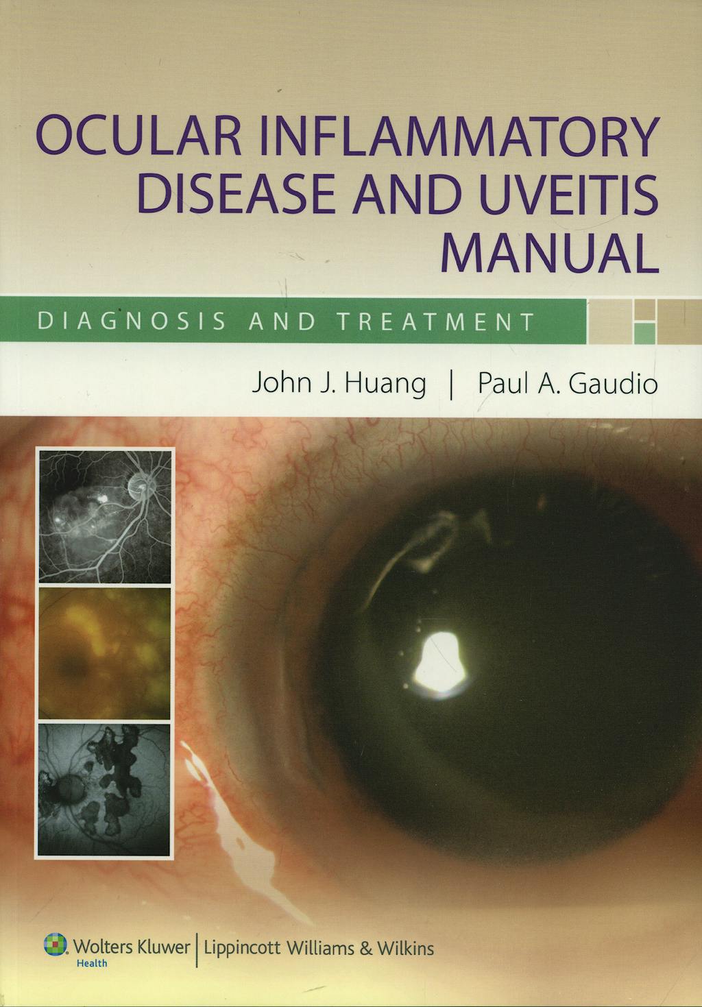 Portada del libro 9780781798365 Ocular Inflammatory Disease and Uveitis Manual. Diagnosis and Treatment
