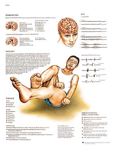 Lamina Epilepsia (formato 50 x 67 cm)