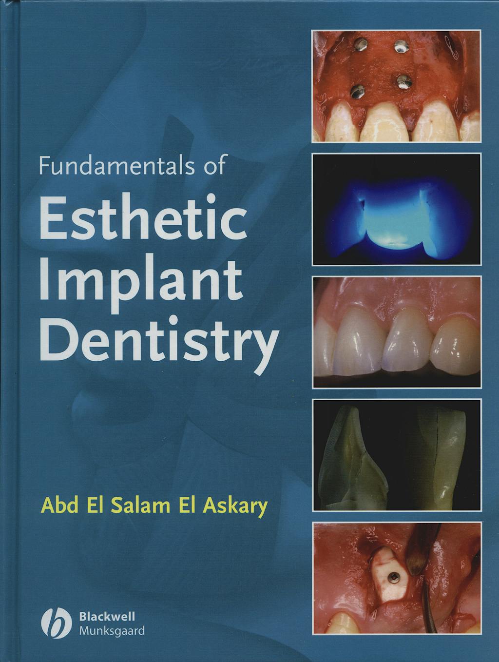 Portada del libro 9780813814483 Fundamentals of Esthetic Implant Dentistry