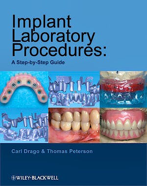 Portada del libro 9780813823010 Implant Laboratory Procedures: A Step-by-Step Guide