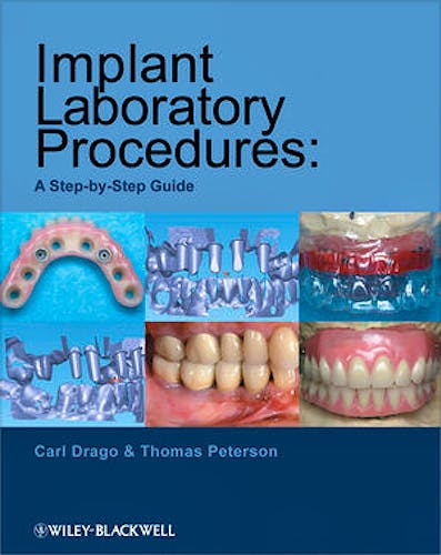 Portada del libro 9780813823010 Implant Laboratory Procedures: A Step-by-Step Guide