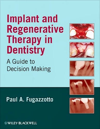 Portada del libro 9780813829623 Implant and Regenerative Therapy in Dentistry. a Guide to Decision Making