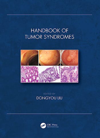 Portada del libro 9780815393801 Handbook of Tumor Syndromes