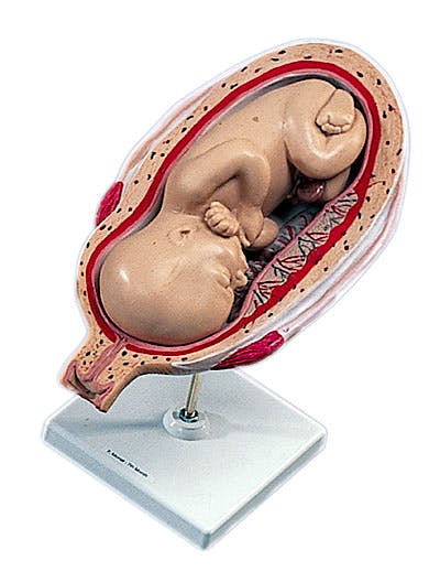 Útero con Embrión, Septimo Mes, 2 Partes