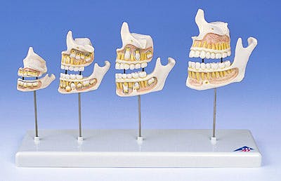 Desarrollo de la Denticion