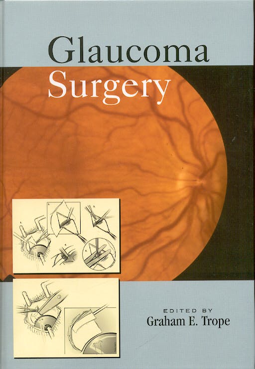 Portada del libro 9780824727437 Glaucoma Surgery