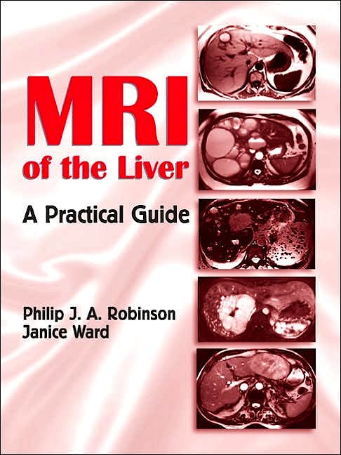Portada del libro 9780824728717 Mri of the Liver. a Practical Guide