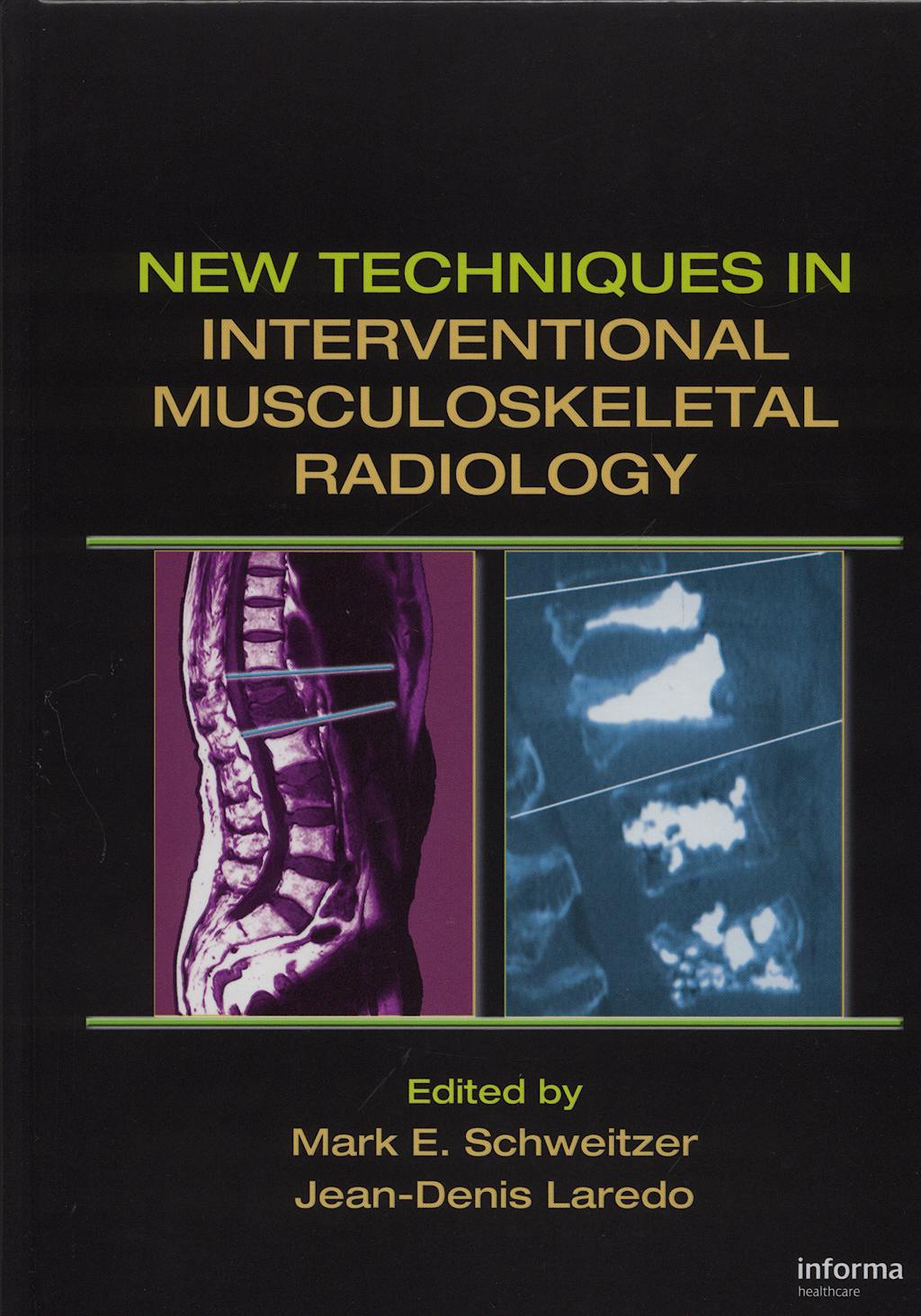 Portada del libro 9780824754457 New Techniques in Interventional Musculoskeletal Radiology