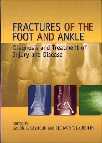 Portada del libro 9780824759162 Fractures of the Foot and Ankle