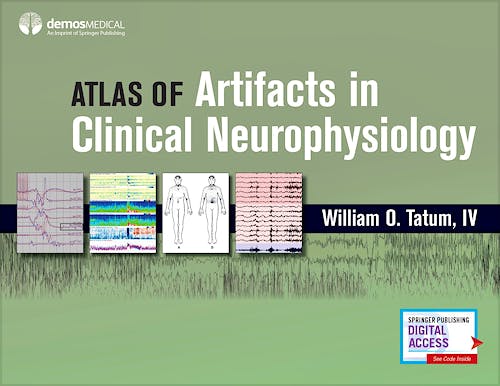 Portada del libro 9780826169341 Atlas of Artifacts in Clinical Neurophysiology