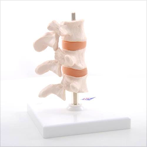 Modelo de Osteoporosis, 3 Vertebras
