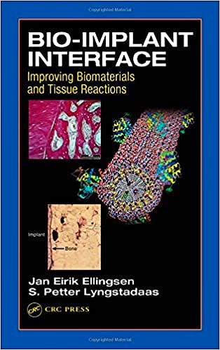 Portada del libro 9780849314742 Bio-Implant Interface: Improving Biomaterials and Tissue Reactions