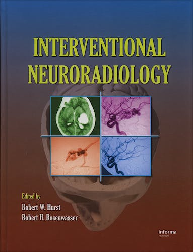 Portada del libro 9780849395628 Interventional Neuroradiology