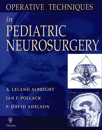 Portada del libro 9780865778467 Operative Techniques in Pediatric Neurosurgery