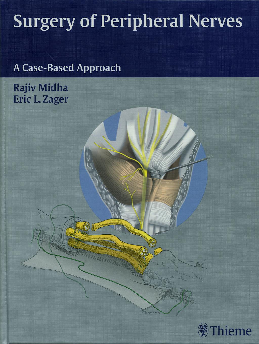 Portada del libro 9780865778603 Surgery of Peripheral Nerves. a Case-Based Approach