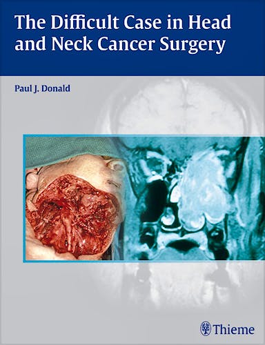 Portada del libro 9780865779846 The Difficult Case in Head and Neck Cancer Surgery