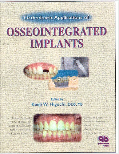 Portada del libro 9780867153569 Orthodontic Applications of Osseointegrated Implants