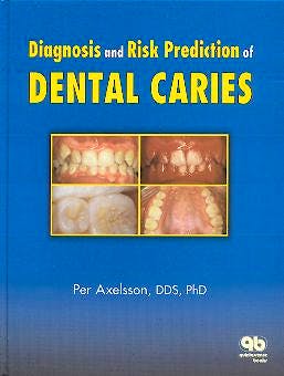 Portada del libro 9780867153620 Diagnosis and Risk Prediction of Dental Caries
