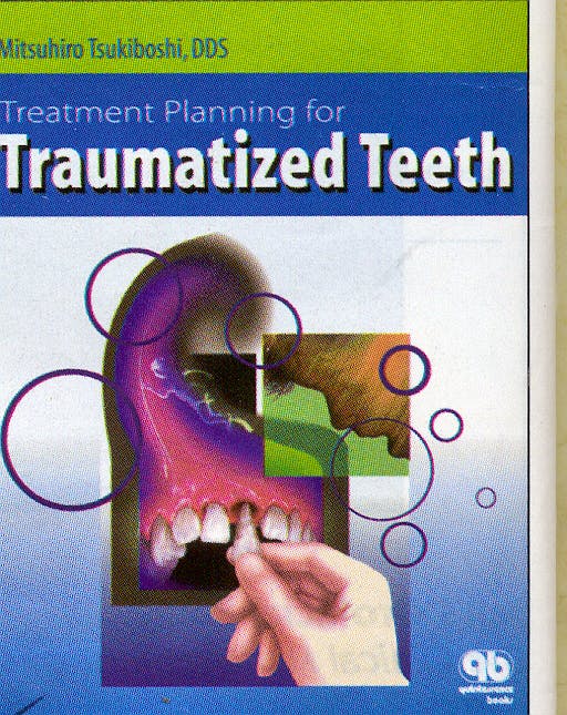 Portada del libro 9780867153743 Treatment Planning for Traumatized Teeth