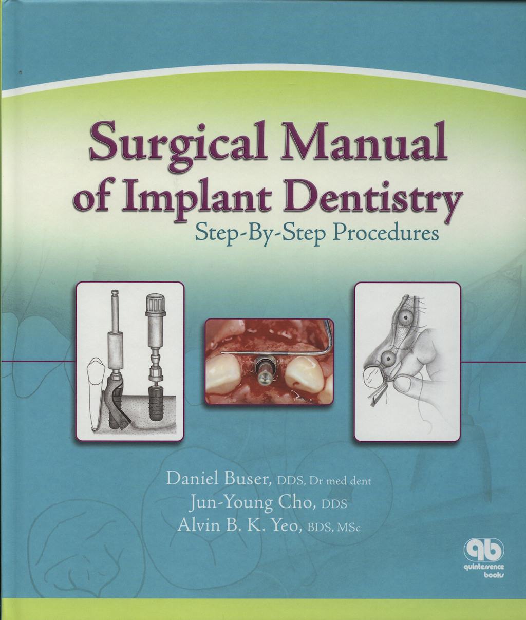 Portada del libro 9780867153798 Surgical Manual of Implant Dentistry