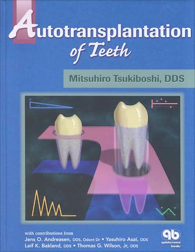 Portada del libro 9780867153958 Autotransplantation of Teeth