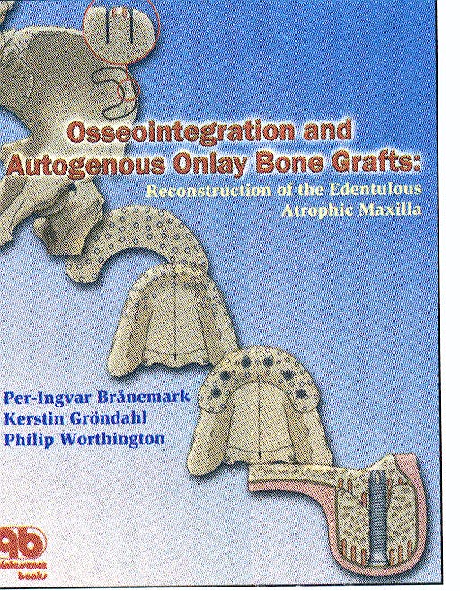 Portada del libro 9780867153989 Osseointegration and Autogenous Onlay Bone Grafts
