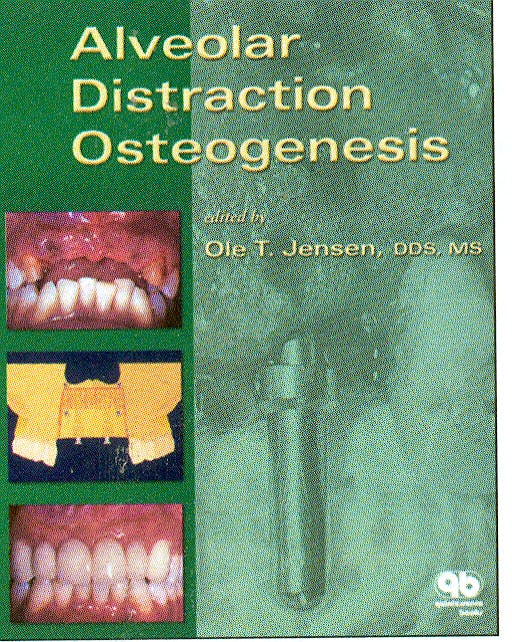 Portada del libro 9780867154146 Alveolar Distraction Osteogenesis